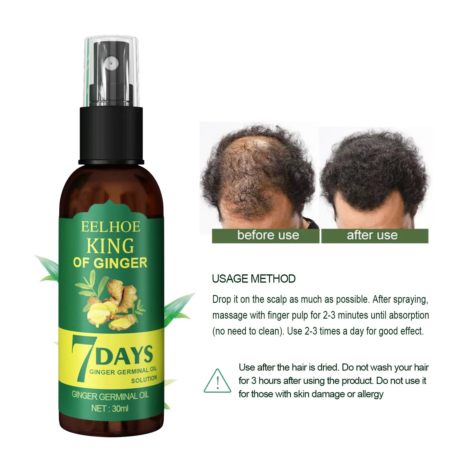 EELHOE Ginger Hair Growth Spray – Root Nourishing & Anti-Hair Loss Scalp Treatment