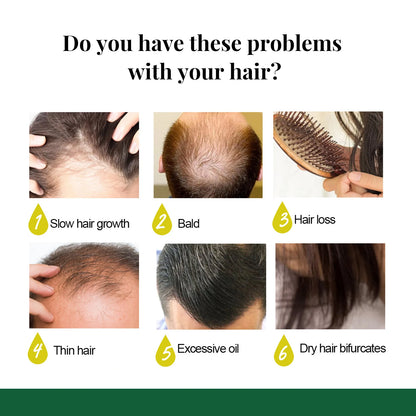 EELHOE Ginger Hair Growth Spray – Root Nourishing & Anti-Hair Loss Scalp Treatment